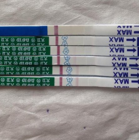 汕头地区有哪些私立的机构可以做试管技术？熊猫血(rh阴性血)的概率是多少？