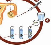 盘锦试管婴儿医院哪里比较好？
