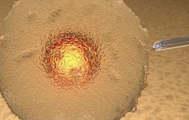 在绍兴做试管婴儿可以医保报销吗？做三代试管需要满足哪些条件？